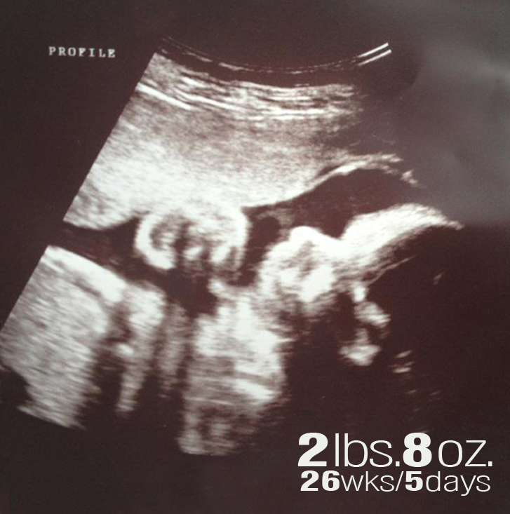 Second sonogram of Claire
